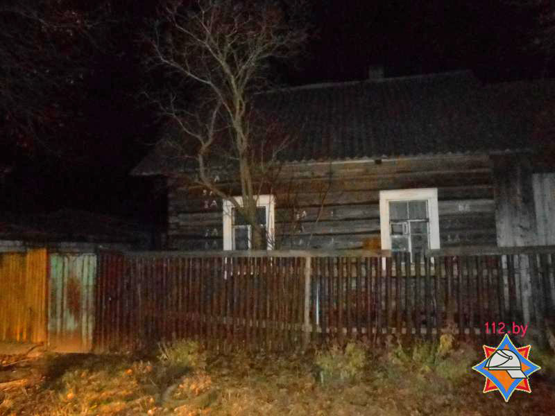 Бобруйчанка умерла в больнице с ожогами 90% тела