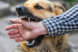 В Бобруйске участились случаи обращения за медпомощью после нападения собак
