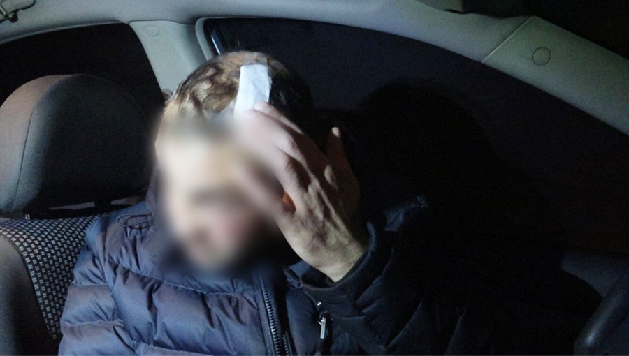 «Это не «Комфорт»: бобруйчанин избил таксиста – ему не понравилась марка прибывшего по вызову автомобиля