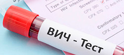 Стало известно, сколько человек с начала года в Беларуси заразились ВИЧ