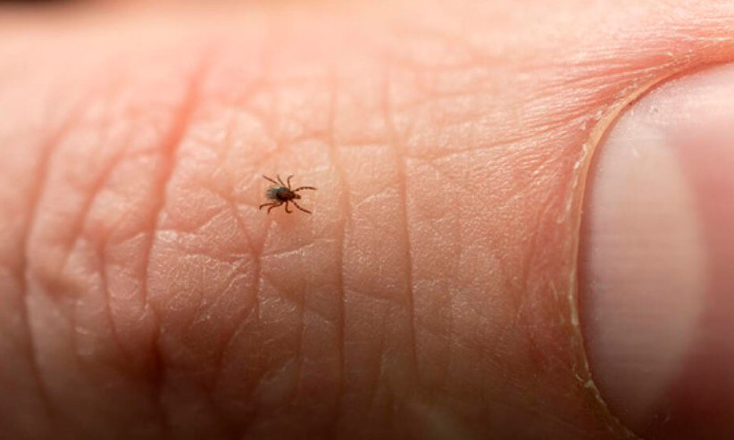 С начала года в Могилевской области зарегистрировано 44 случая заболевания лайм-боррелиозом. Это в два раза больше, чем за аналогичный период прошлого года, сообщили в Могилевском областном центре гигиены, эпидемиологии и общественного здоровья.