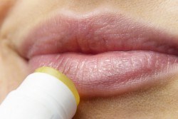 Что делать, если губы обветрились: 5 способов спасти потрескавшиеся губы
