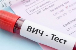Где в Бобруйске можно сделать экспресс-тест на ВИЧ-инфекцию