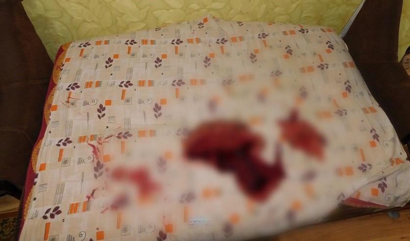 В Бобруйске пенсионер убил сожителя дочери. Она пыталась спасти мужчину, но пострадала сама