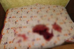В Бобруйске пенсионер убил сожителя дочери. Она пыталась спасти мужчину, но пострадала сама (видео)