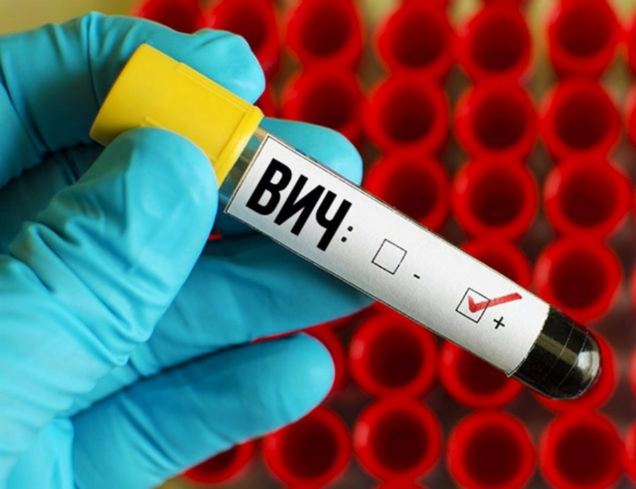14 новых случаев ВИЧ зарегистрировано в январе в Могилевской области