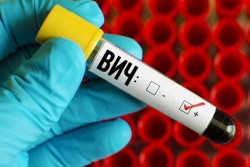 14 новых случаев ВИЧ зарегистрировано в январе в Могилевской области