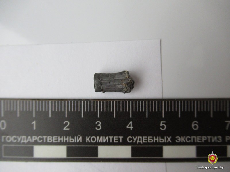 Из головы пострадавшего извлекли пулю. Фото: ГКСЭ РБ.