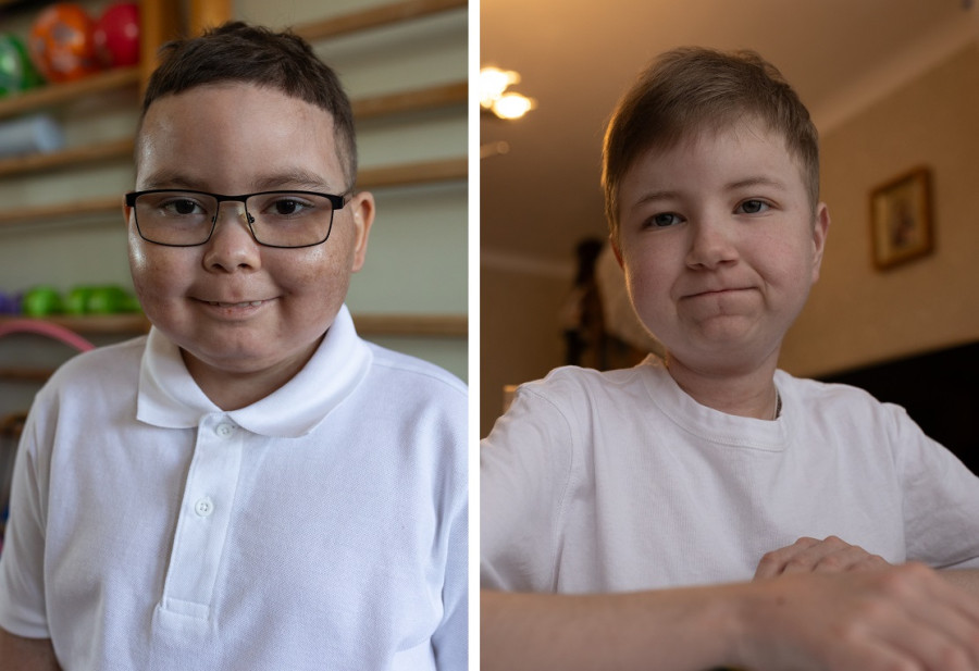 Цена улыбки: как новейшая медицина и милосердие белорусов помогают Жене и Ване